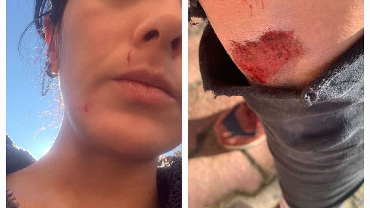 Kadın gazeteciye saldırı