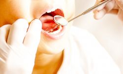 Flor diş çürüklerini yüzde 20 ile 40 arasında engelliyor