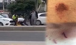 Diyarbakır’da polis şiddeti