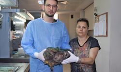 Karnından 10 kiloluk dev tümör çıkartıldı