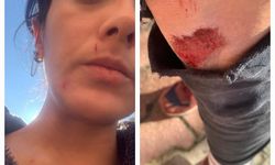 Kadın gazeteciye saldırı