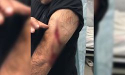 Öğretmene sokak ortasında jiletli saldırı