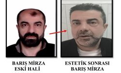 Cinayet zanlısı ameliyatla yüzünü değiştirdi,7 yıl sonra yakalandı