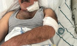 Diyarbakır’da at sahibini boğazından ısırdı