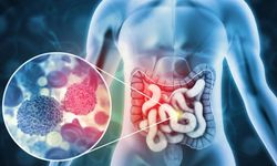 Sessiz ilerleyen tehlike: Kolon Kanseri