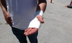 Acemi kasaplar hastanelere koştu