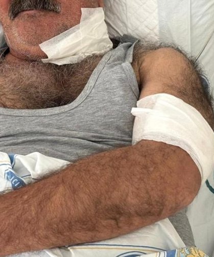 Diyarbakır’da at sahibini boğazından ısırdı