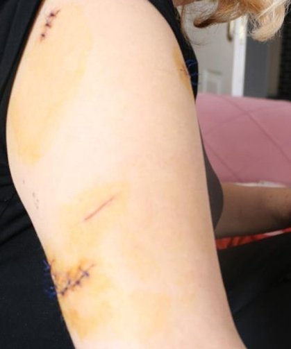 Diyarbakır’da dehşet: dini nikahlı eşini 30 yerinden bıçakladı