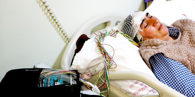 Epilepsi hastalarına EEG sistemi ile tanı konuluyor (VİDEO)