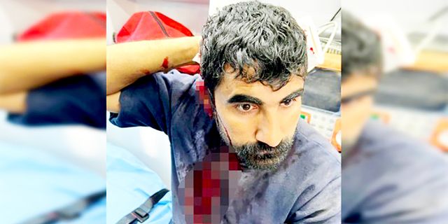 İHD Diyarbakır Şubesi’nden tüm kesimlere çağrı:  Irkçılığı reddeden anlayışı yaygınlaştırın