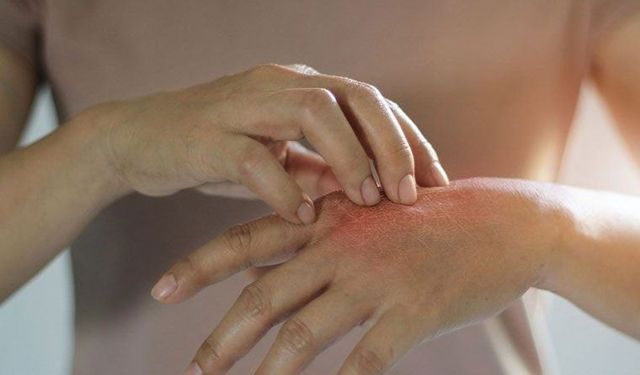 Duştan sonra kaşıntı varsa dikkat!