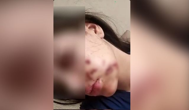 Çocukların maytabı, genç kızın yüzünde patladı!