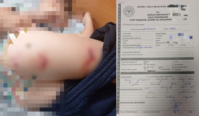 Diyarbakır’da sokak köpeği dehşeti: 9 yaşındaki çocuk defalarca ısırıldı