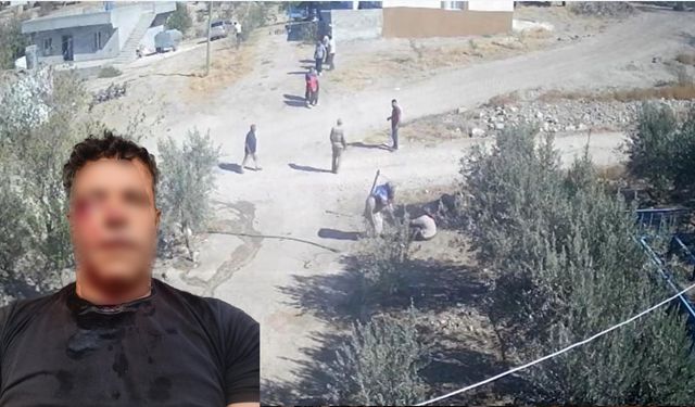 Şanlıurfa'nın konuştuğu kadın; Kafası taşla ezilmek istenen baygın kocasını kurtardı