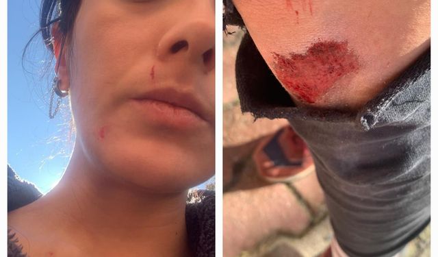 Kadın gazeteciye saldırı