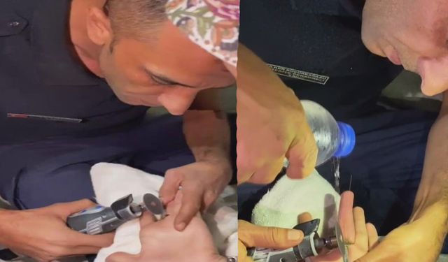 Parmağa sıkışan yüzüğü itfaiye ekipleri çıkardı