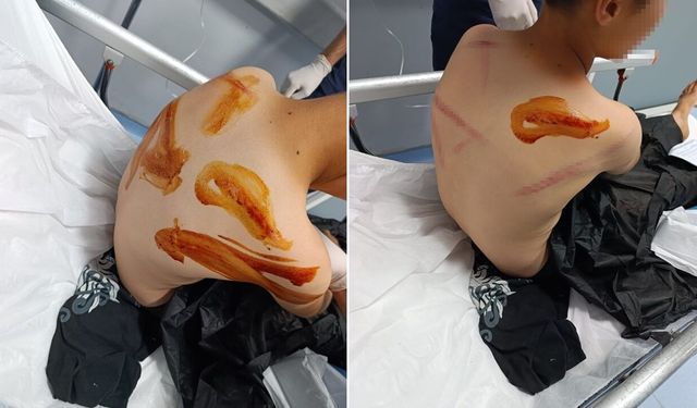 11 yaşındaki çocuğa sopayla acımasızca vurdu