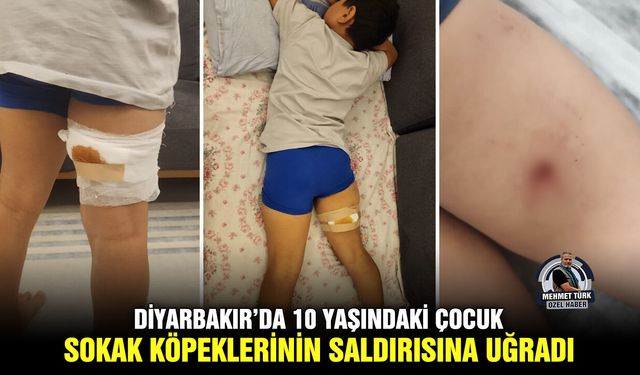 Diyarbakır’da 10 yaşındaki çocuk sokak köpeklerinin saldırısına uğradı