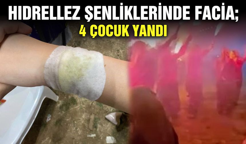 Hıdrellez şenliklerinde facia; 4 çocuk yandı