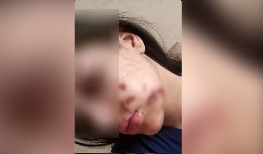 Çocukların maytabı, genç kızın yüzünde patladı!