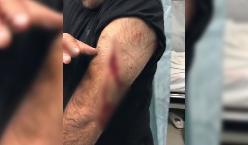 Öğretmene sokak ortasında jiletli saldırı