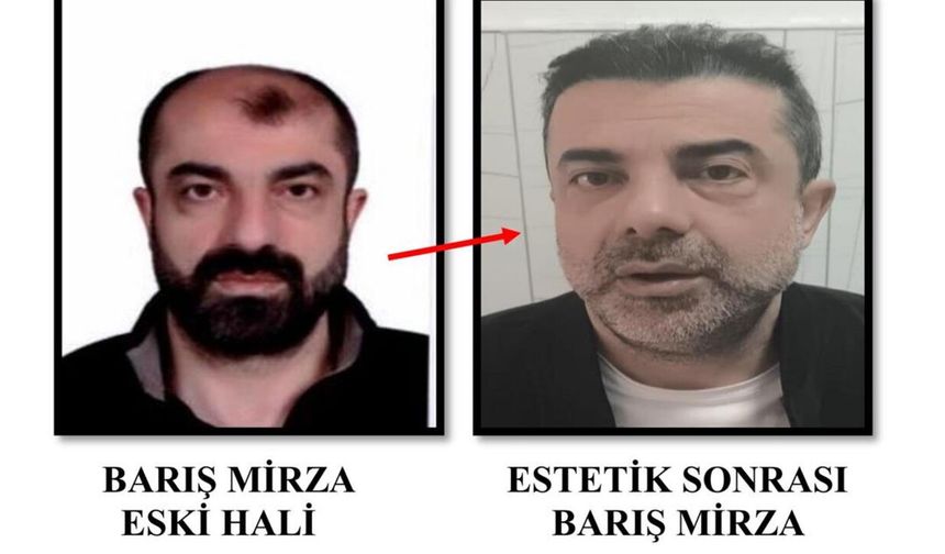 Cinayet zanlısı ameliyatla yüzünü değiştirdi,7 yıl sonra yakalandı