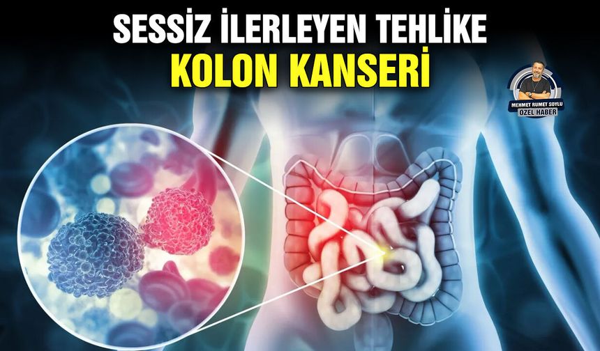 Sessiz ilerleyen tehlike: Kolon Kanseri