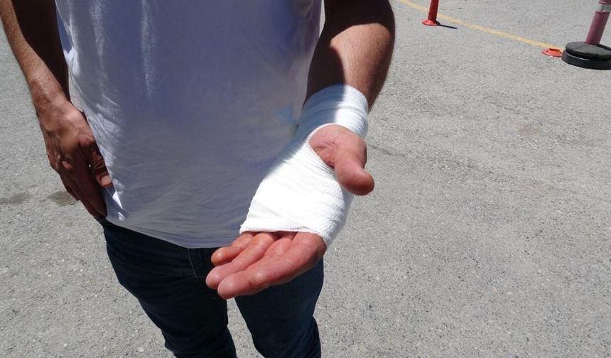 Acemi kasaplar hastanelere koştu