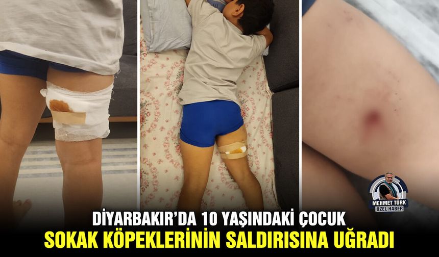 Diyarbakır’da 10 yaşındaki çocuk sokak köpeklerinin saldırısına uğradı
