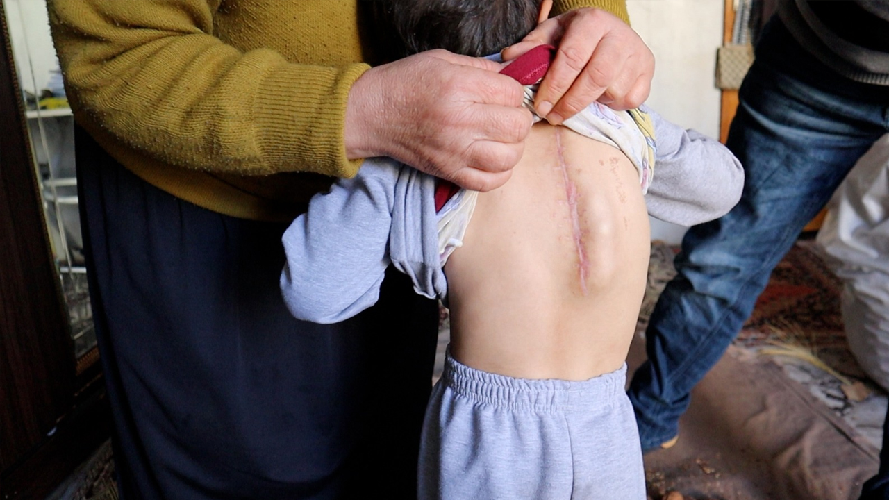 Diyarbakır’da Bir Annenin Hasta Evladı Için Örnek Mücadelesi3