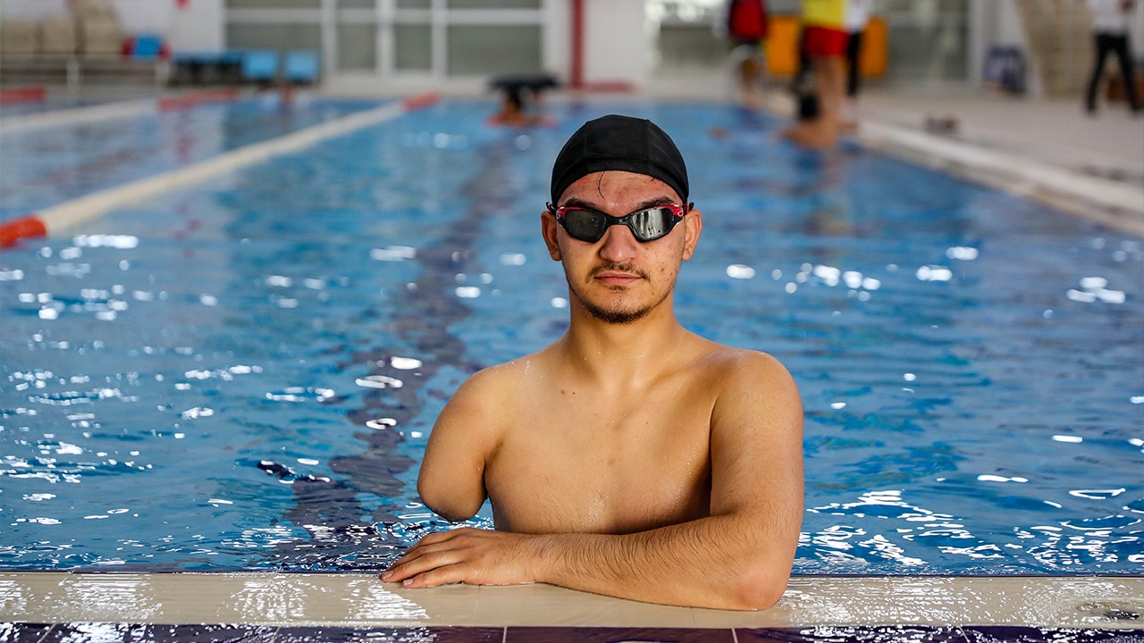 Diyarbakır’daki Patlamada Kolunu Ve Bacağını Kaybetmişt3