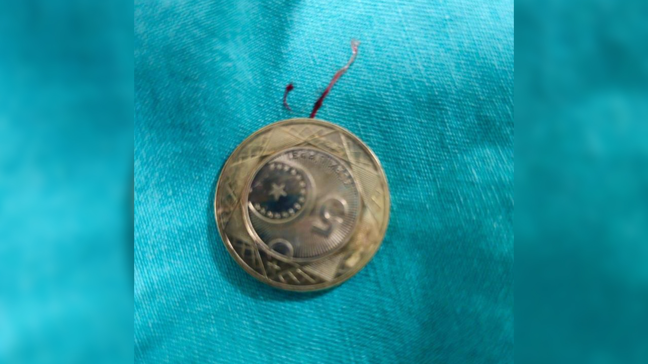 Boğazına Para Kaçan Çocuk, Az Daha Canından Oluyordu