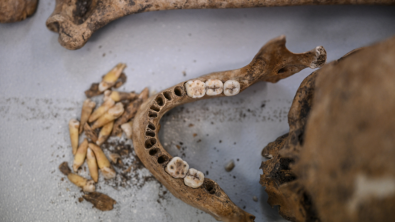 Diyarbakır Çayönü Tepesinin Genetik Haritası Çıkarılıyor4