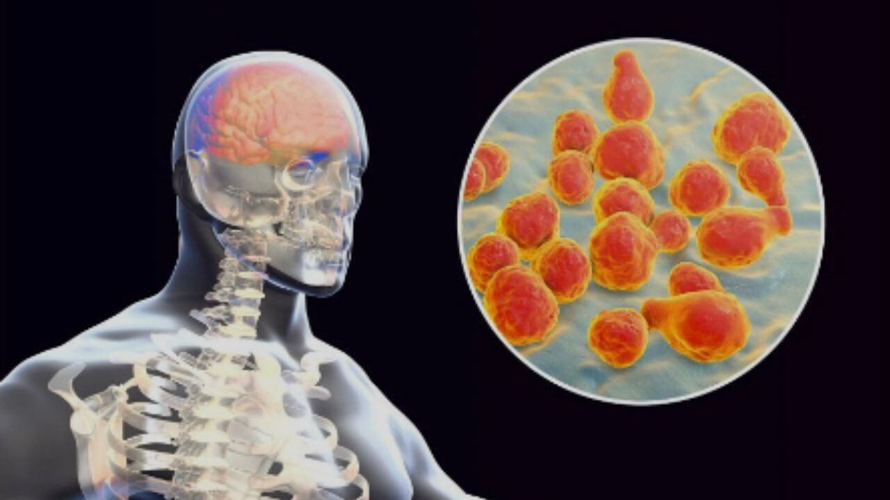 Sessiz Ama Tehlikeli Hastalık3