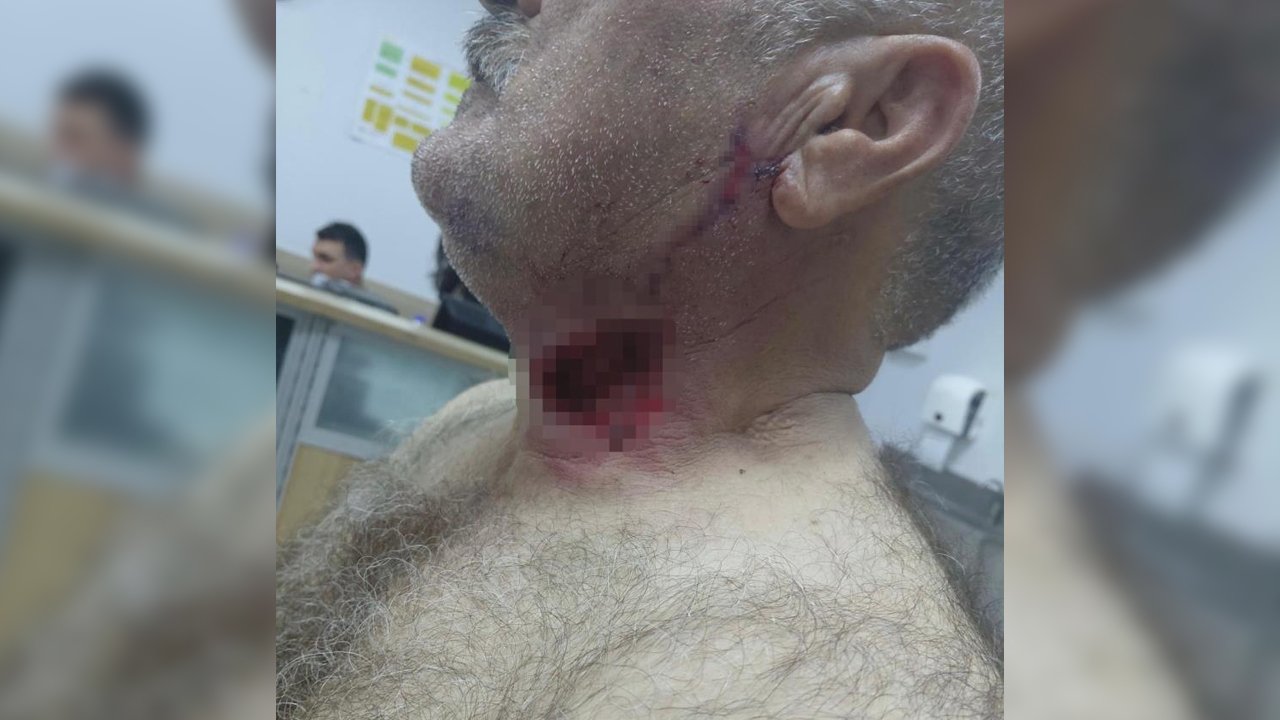 Diyarbakır’da At Sahibini Boğazından Isırdı1