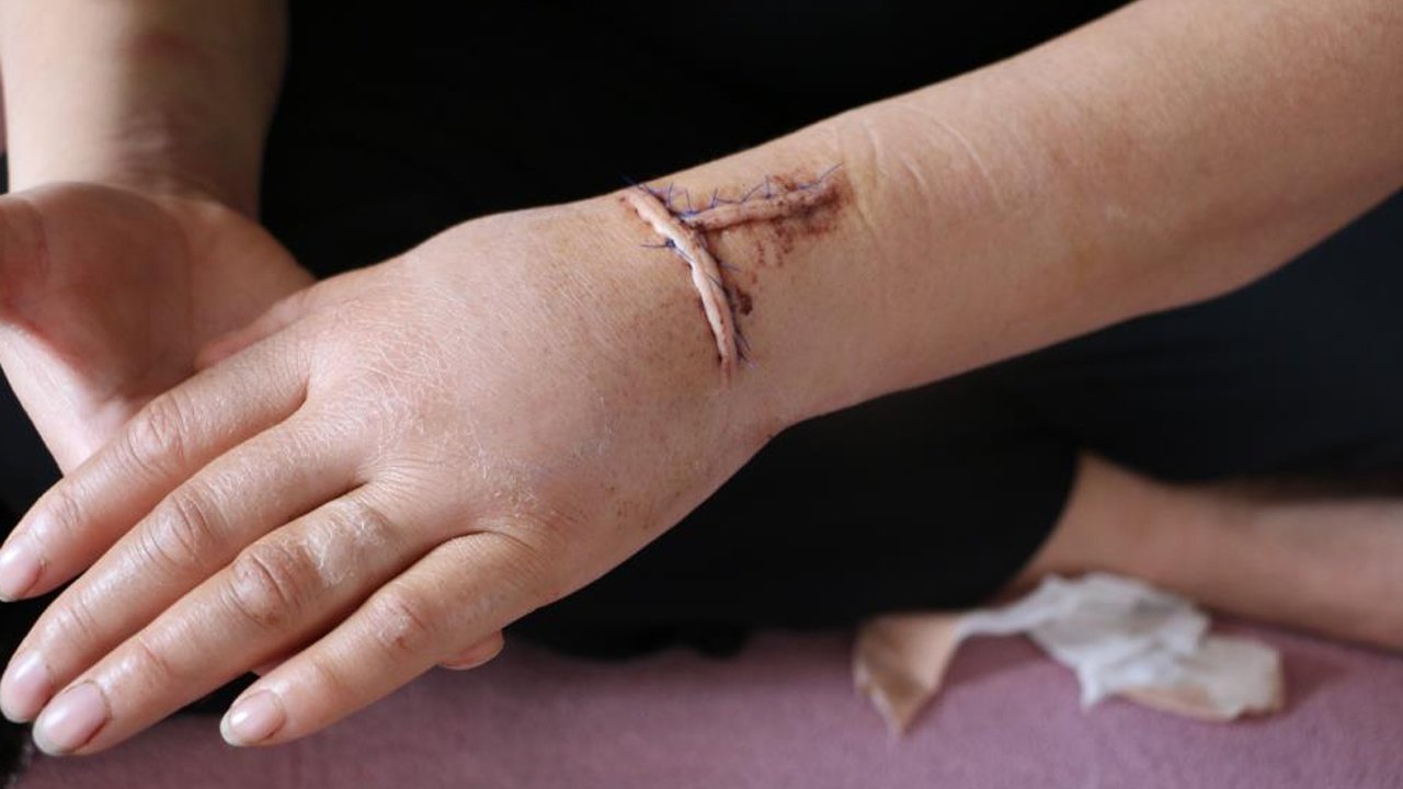 Diyarbakır’da Dehşet Dini Nikahlı Eşini 30 Yerinden Bıçakladı1