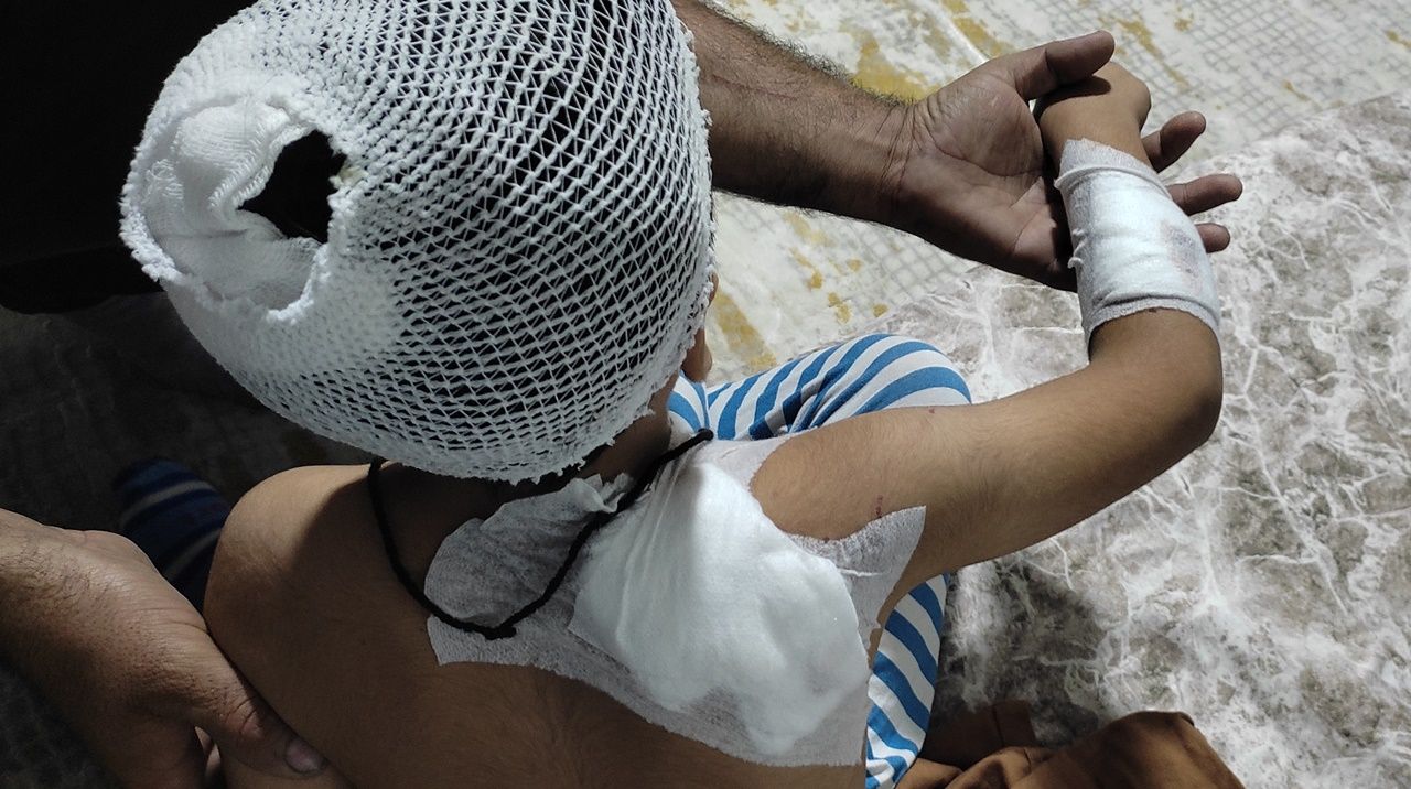 Sahipsiz köpeklerin saldırısına uğrayan çocuk yaralandı
